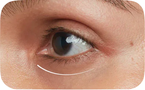 Close-up of a human eye with dark iris and eyelashes, showing natural skin texture