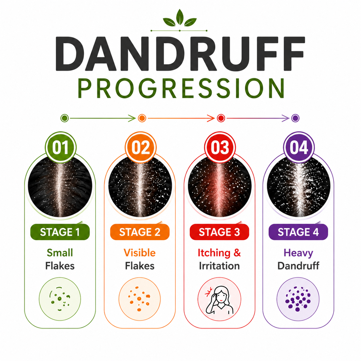 Anti Dandruff Kit